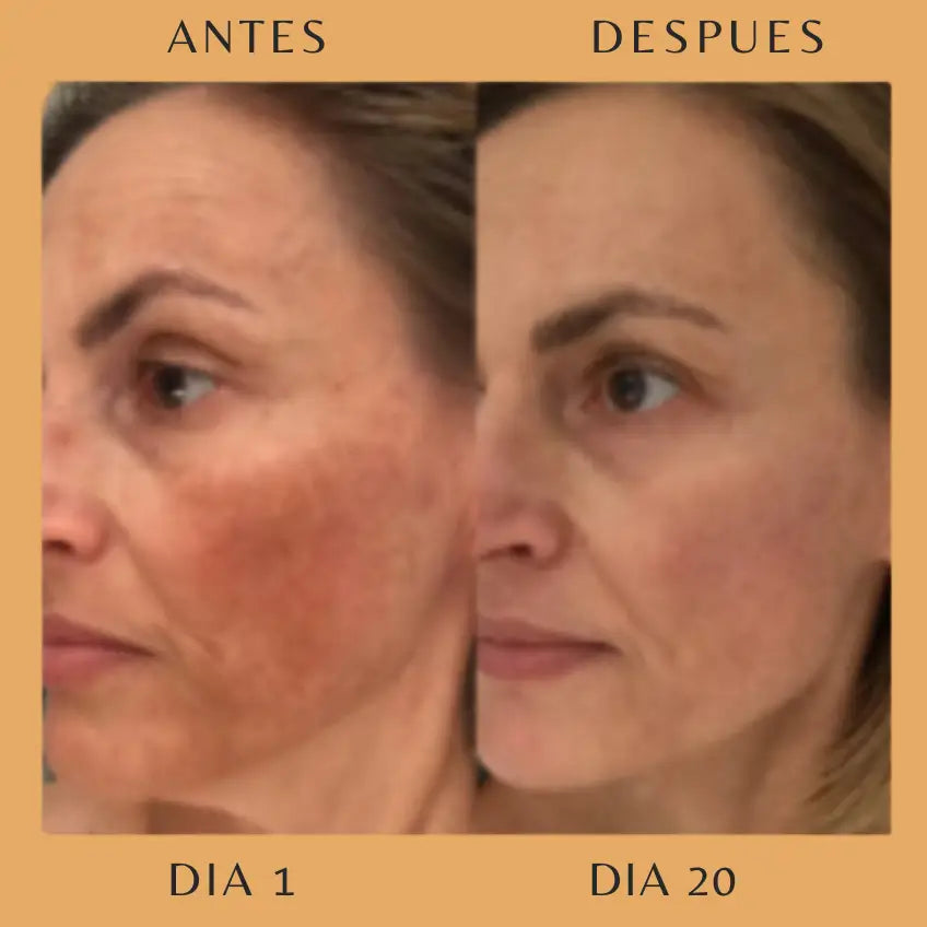 Varita Rejuvenecedora 4Skin